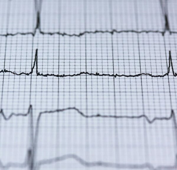 apex node neural pulse