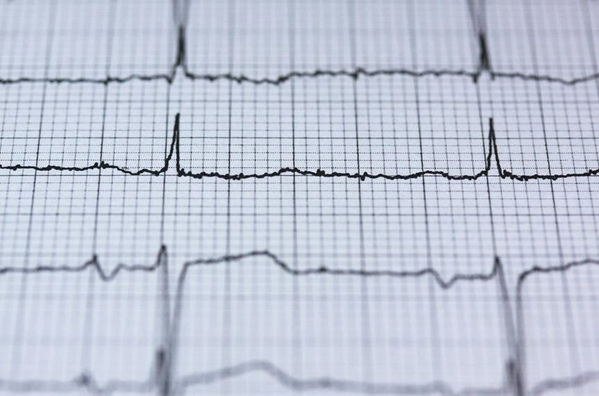 apex node neural pulse